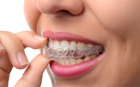 woman holding Clear Braces