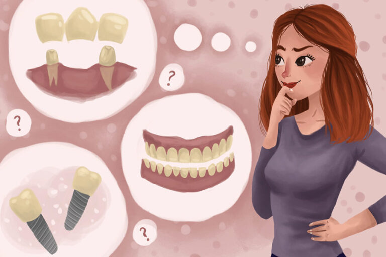 Cartoon with thought bubbles showing a woman thinking about a dental bridge or a dental crown